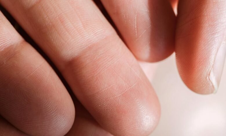 low response rate contacts